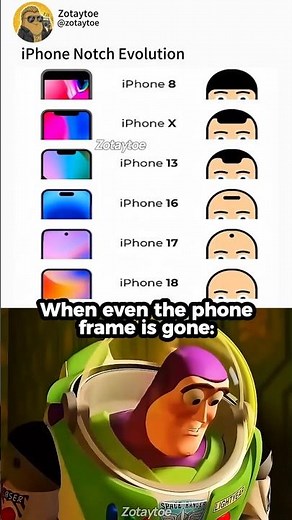 Bro becoming bald 💔