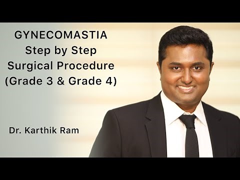 GYNECOMASTIA - STEP BY STEP SURGICAL PROCEDURE ( GRADE 3 & GRADE 4) BY DR KARTHIK RAM