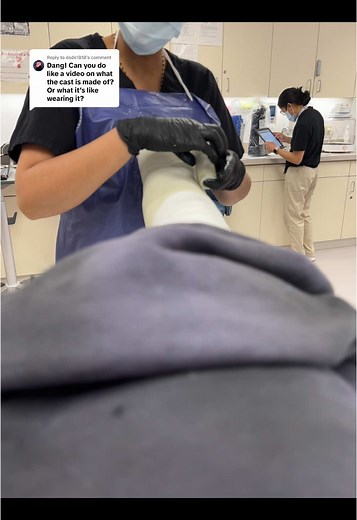 How to Apply a Leg Cast for Broken Ankles