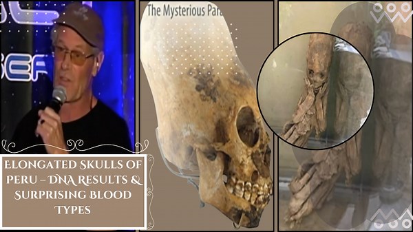 Elongated Skulls of Peru – DNA Results & Surprising Blood Types