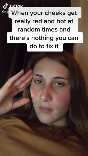 Understanding Hot Cheeks: Causes and Remedies