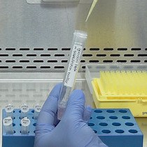 Video: Visualizing Intracellular SNARE Trafficking by Fluorescence Lifetime Imaging Microscopy