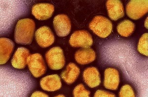 Affenpocken: WHO gibt Empfehlungen zu Sexualverhalten