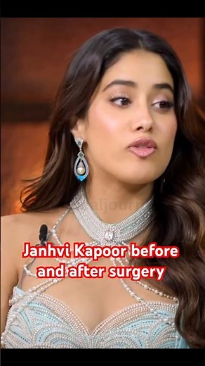Janhvi Kapoor before and after #janhvikapoor #bollywoodshorts #sridevi #plasticsurgery
