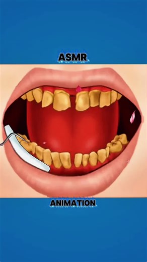 ASMR Teeth Cleaning Treatment Animation