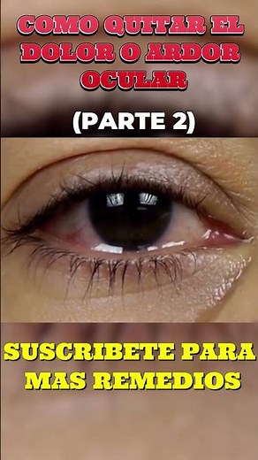 How to Relieve Eye Pain or Burning - What Is Good for Burning Eyes (PART 2)