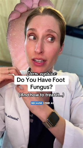 Follow for more practical skin tips in 2026! #footfungus #dryfeet #tineapedis #athletesfoot #podiatry