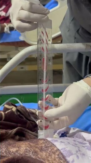 how to measure the CVP line ..check the complete video..