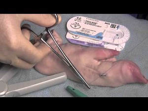 Laceration Repair (simple repair)