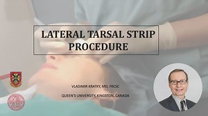 LATERAL TARSAL STRIP PROCEDURE