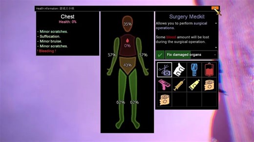 【GMOD】模组推荐：细致化玩家健康值系统