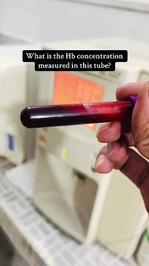 What is the Hb concentration measured in this tube? #foryou #foryourpage #labtechnician #laboratory