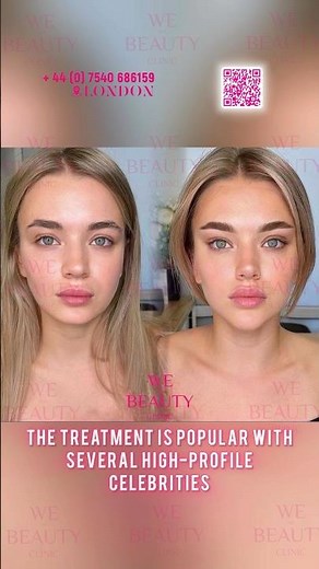 Fox eye lift 🦊🪡