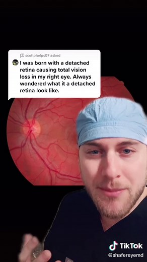 Understanding Retinal Detachment Symptoms and Treatment