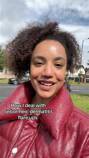 Seborrheic dermatitis flare ups
