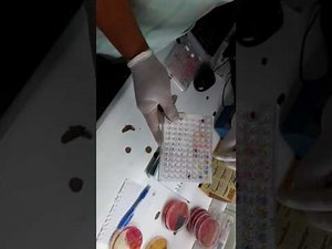 Panel MicroScan para identificacion