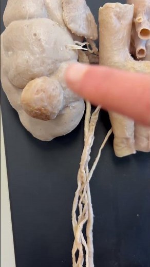 Check out this real male anatomy dissection! Highlighting male sexual organs 🍆. #anatomy