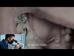 What Expect!😮Professional Teeth Cleaning A Dentist's Step-by-Step #005