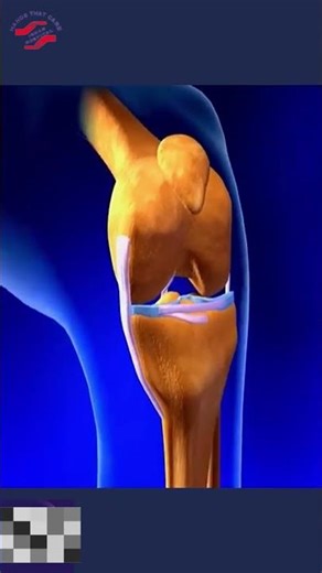 meniscus tear vs ligament tear