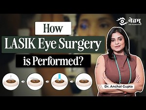How is LASIK Eye Surgery Done? | LASIK Eye Surgery Procedure | Netram Eye Foundation