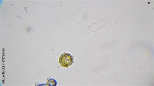 Empty diatom with nearby live cyanobacteria as a ciliate swims past under 2000x brightfield microscopy with immersion oil. Detailed microscopic view of micro ecosystem.