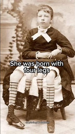 The girl with four legs #history #painting #arthistory