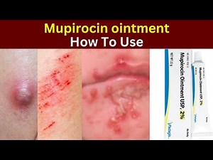 Mupirocin ointment how to use | Dose | Side effects | Mupirocin for skin infections