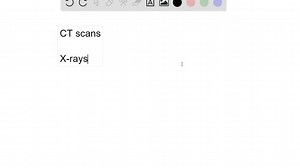 A CT or CAT scan relies on a circling scanner that revolves around the patient's body. Watch this video (http://openstaxcollege.org/I/CATscan) to learn more about CT and CAT scans. What type of radiation does a CT scanner use? | Numerade