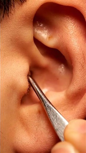 Gentle & Satisfying Ear Pick ASMR | Relaxing Macro Loop #asmr #satisfying #earpick