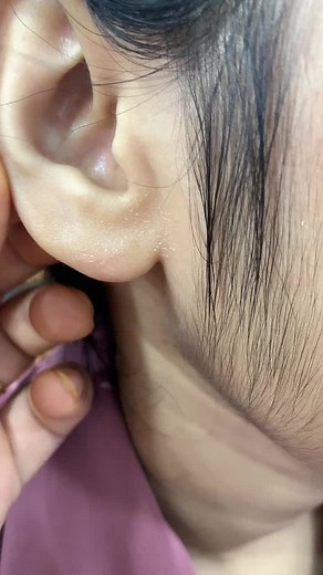 Exploring Ear Anatomy and Piercing Techniques