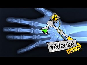 Jak funguje rentgen? - Vědecké kladivo