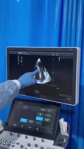 Understant critical care U/S in ICU roud 4 Register in our recorded online course to learn so many critical care U/S tricks which will change your way of management and boost your ICU skills. We are continuously upgrading our courses., so you will expect new lectures to be added to your course from time to time. Attention please, now the complete Lower Limb arterial and venous Doppler course is added to our recorded critical care U/S from basic to advanced course. Also, this week 10 new lectures