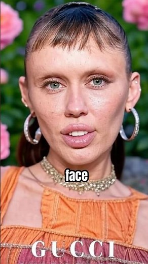 What Happened To Miley Cyrus Face? #shorts #mileycyrusedit