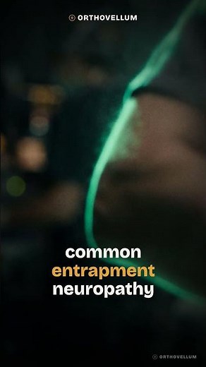 Cubital Tunnel Syndrome Explained: Ulnar Nerve Entrapment Masterclass