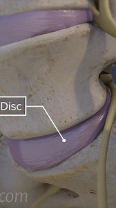 See how a L5-S1 degenerative disc causes pain. | Spine-health