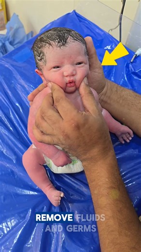 Why Doctors Give Newborns Their First Bath Doctors bathe newborns to remove birth fluids and lower infection risk, but they wait hours before cleaning off the protective vernix that shields the skin. This essential first bath supports infant health, hygiene, and early care—topics parents love, including childcare tips, health insurance, and pediatric wellness insights. Credits: babyfirstbreath /YT #baby #babylove #babies #Bath #babybathtub | Daily Facts