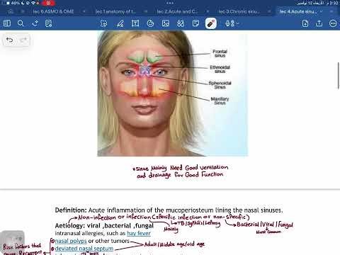 ENT nose acute sinusitis