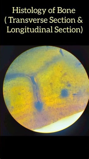 #Shorts #histology of Bone #CompactBone #anatomy #medical #science #biology #medicalstudent #MBBS