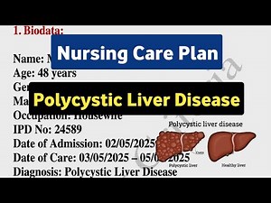 Nursing Care Plan on Polycystic Liver Disease / Nursing Criteria