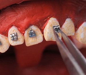 What Really Happens at the Dentist | 5-Minute Crafts