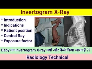 Invertogram X-ray # Invertogram Procedure # Patient position # Exposure factor #xrayclasses