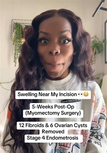 Swelling Near My Incision: 5 Weeks Post-Myomectomy