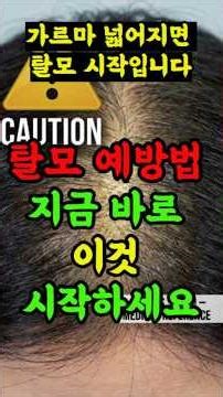 가르마 넓어지면 바로 이것 하세요 갱년기여성 탈모 예방법 #시니어건강 #건강한중년 #쇼츠 #건강정보 #건강여성탈모 #가르마탈모 #갱년기탈모 #두피관리 #탈모자가진단