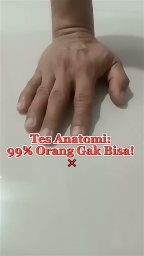 Anatomy Test: 99% of People Can't Do It! ❌