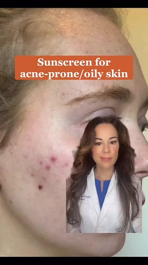 Eucerin Sun Oil Control SPF 50 Sunscreen for Oily, Acne-Prone Skin
