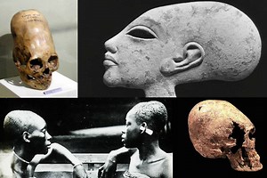 A Look at Theories About Elongated Skulls in Ancient Peru, Europe, Egypt