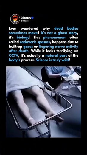 Cadaveric Spasms: Real Life or Horror? 😱 #shorts