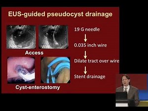 History and Future of Endoscopy from an Interventional Endoscopist's Perspective