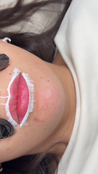 Lip Blush Correction: Fixing Asymmetry