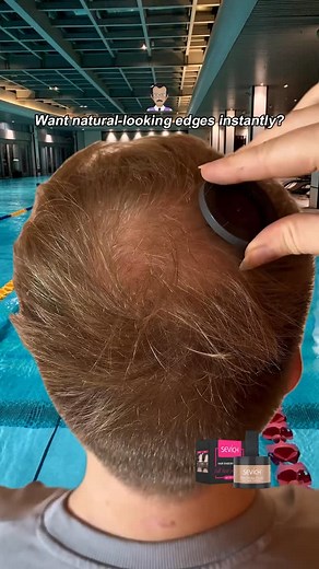 Bald spots? Receding hairline? We feel you. 😔 Our Hairline Powder blends seamlessly with your roots, creating an undetectable finish. Why choose us? 🔹 OEM/ODM support for custom branding 🔹 Long-lasting & easy to apply 🔹 Trusted by salons worldwide Ready to redefine your hair game? 💪 👉 DM us for bulk orders or collaborations!#HairFiber #HairlinePowder #OEMHairCare #BeautySupply #HairLossSolution #PrivateLabel #HairThickness #InstaHair #NoMoreThinHair #HairBoost #HairlineSolution #OEMHair #B